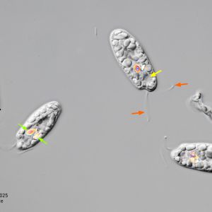 gal chilomonas paramecium