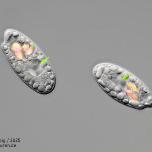 gal chilomonas paramecium