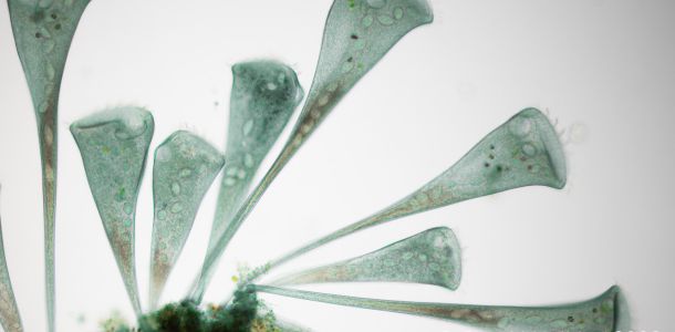 gal stentor coeruleus