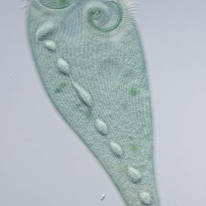 gal stentor coeruleus