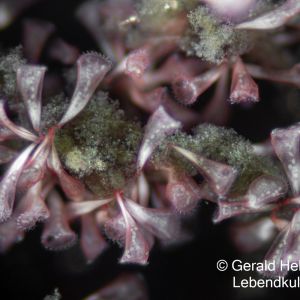 gal stentor coeruleus