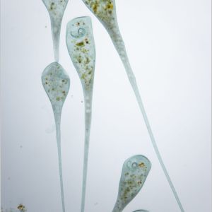 gal stentor coeruleus