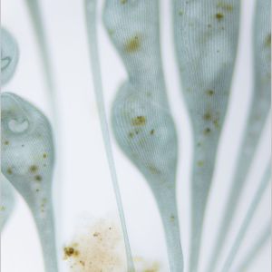 gal stentor coeruleus