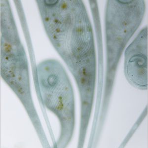 gal stentor coeruleus